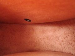 IMG 3916 Es