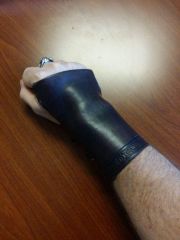 Wrist brace